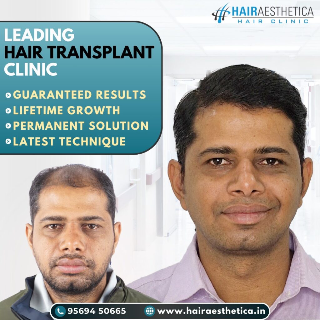Advanced-Affordable-Hair-Transplant-Solutions-for-Natural-Results